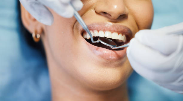 Best Emergency Denture Repair in High Ridge, MO